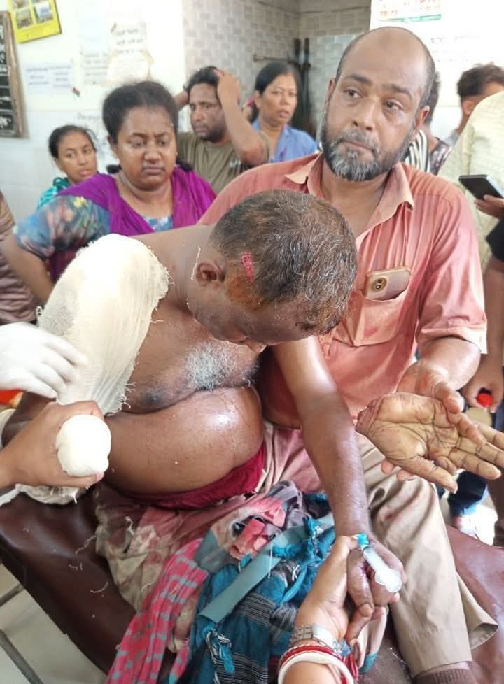 বিএনপি নেতার হাত বিচ্ছিন্ন, আওয়ামী লীগের আমলে হারিয়েছেন পা