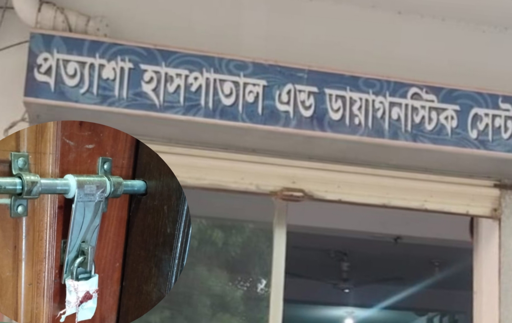 অচেতন রোগী নিয়ে নার্সের টিকটক, সিলগালা অপারেশন থিয়েটার